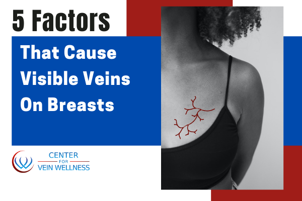 Veiny Breasts During Pregnancy - Why Veins Are Suddenly Visible